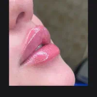 جشنواره تحول زیبایی ژل.بوتاکس.لیزر.مزو.توسط پزشک|خدمات آرایشگری و زیبایی|قم, زنبیل آباد|دیوار