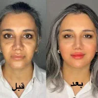 انجام خدمات ژل و بوتاکس و تمامی جراحی ها
