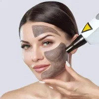 کربن تراپی تخصصی+حذف کک و مک و تتو با لیزر