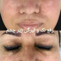 جشنواره تخفیفات کلینیک پوست همراه با هدیه|خدمات آرایشگری و زیبایی|مشهد, کوه سنگی|دیوار