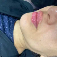 خدمات فیلر و بوتاکس|خدمات آرایشگری و زیبایی|خرمشهر, |دیوار