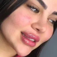 جشنواره ۳۰٪ تابستانه فیلر/بوتاکس/پی ار پی|خدمات آرایشگری و زیبایی|اهواز, کیان اباد|دیوار