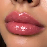 هزینه تزریق هر سی سی ژل فقط 900تومان