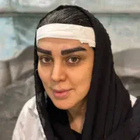 کاشت مو و ابرو شیرازی در اصفهان|خدمات آرایشگری و زیبایی|لنجان, |دیوار