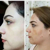 کرم معجزه vip سفیدکننده،از بین برنده لک،کک و مک|آرایشی، بهداشتی، درمانی|مشهد, شهید هاشمی نژاد|دیوار