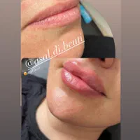 تخفیف ویژه ژل لب، فول فیس اموزش و تمام خدمات|خدمات آرایشگری و زیبایی|صدرا-فارس, فاز ۱|دیوار