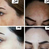 معجزه پوست شمادردستان مااست ارزش امتحان کردن داره|آرایشی، بهداشتی، درمانی|خان ببین, |دیوار