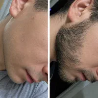 دیگه نیازی به کاشت نیست