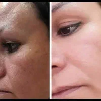 کرم معجزه آسا شب|آرایشی، بهداشتی، درمانی|ساری, |دیوار