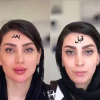 جشنواره بوتاکس و ژل فیلر توسط دکتر شریفی