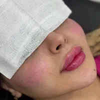 سلامت پوست مو