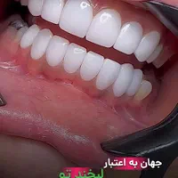 کامپوزیت دندان ،لمینت،بلیچینگ (آف بهاری)|خدمات آرایشگری و زیبایی|اصفهان, خانه اصفهان|دیوار