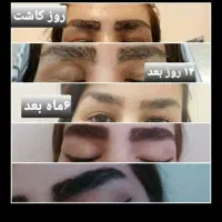 جشنواره کاشت مو و ابرو در تهران و کرج|خدمات آرایشگری و زیبایی|تهران, صاحبقرانیه|دیوار