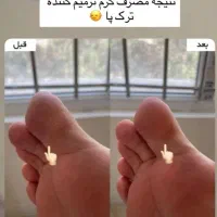 کرم ترکپا وروغن شتر مرغ