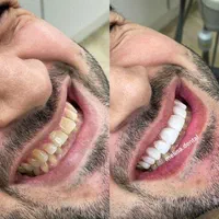 کلیه خدمات دندانپزشکی با بیمه های تکمیلی|خدمات آرایشگری و زیبایی|تهران, جهاد|دیوار