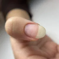 دوره رفع اشکال ناخن و آپدیت