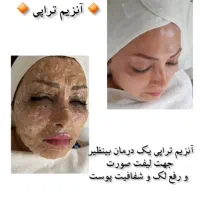 خدمات فیشیال حرفه ای و تراپی های تخصصی پوست|خدمات آرایشگری و زیبایی|تهران, تهرانسر شمالی|دیوار
