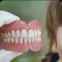 دندان مصنوعی طرح لمینیت