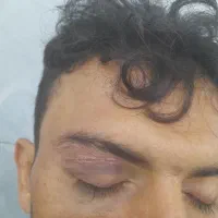 تزریقات وپانسمان در منزل|خدمات آرایشگری و زیبایی|نجفآباد, قدس|دیوار