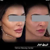 کلینیک فوق تخصصی/کاشت مو / ابرو