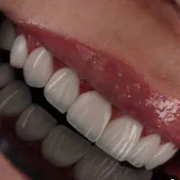 دندانپزشکی تخصصی ، ایمپلنت ، اوردنچر ، زیبایی