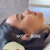 عمل بینی فقط« ۲۹ »میلیون روز ۸  و ۹ اذر|خدمات آرایشگری و زیبایی|تهران, پاسداران|دیوار