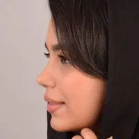 عمل بینی.لیفت|خدمات آرایشگری و زیبایی|کرج, کرج نو|دیوار