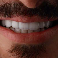 جراح دندانپزشک دکتر دانیال قشقایی|خدمات آرایشگری و زیبایی|کرمانشاه, |دیوار