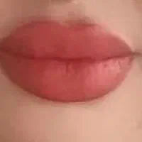 لیزرموهای زائدبادستگاه آلمانی+فیلر+بوتاکس+مزوتراپی|خدمات آرایشگری و زیبایی|کرمان, |دیوار