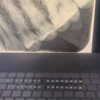 دستیار دندان پزشکی