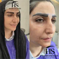 کاشت ابروی طبیعی|خدمات آرایشگری و زیبایی|تهران, قیطریه|دیوار