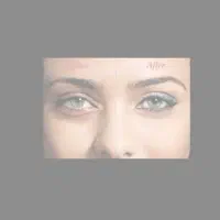 روغن گودی زیر چشم و حجم و لاغری و پاکسازی صورت