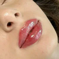 زیبایی طبیعی با تزریق اصولی و مشاوره رایگان