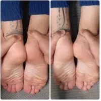 آزادسازی درد سیاتیک واصلاح آن