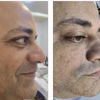 آموزش تخصصی فیشال و پاکسازی پوست|خدمات آموزشی|ارومیه, |دیوار