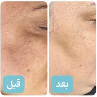 آموزش وخدمات ارایشگری|خدمات آرایشگری و زیبایی|یزد, |دیوار