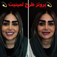 دندانسازی مصنوعی دندان مصنوعی با کیفیت و زیبا