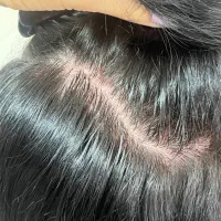 اسکراب و پاکسازی تخصصی کف سر /درخشش و رشد مو|خدمات آرایشگری و زیبایی|صدرا-فارس, فاز ۱|دیوار