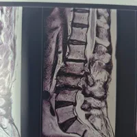 فیزیوتراپی تخصصی در مطب و منزل