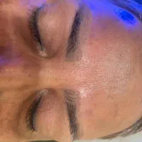 مجهزترین مرکزلیززقم حذف تتوابرو، بدن لک مقاوم صورت|خدمات آرایشگری و زیبایی|قم, بکایی|دیوار