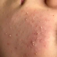 تخفیف آموزش و خدمات فیشال تخصصی بانوان و آقایان|خدمات آرایشگری و زیبایی|مشهد, کوثر|دیوار