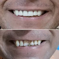 دندانپزشکی