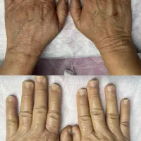 پاکسازی و فیشال تخصصی(بانوان)|خدمات آرایشگری و زیبایی|شاهین‌شهر, حافظ شمالی|دیوار