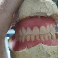 دندان مصنوعی|آرایشی، بهداشتی، درمانی|لردگان, |دیوار