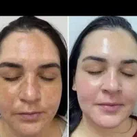 نمایندگی اصلی ضدلک لاکچری کوین|آرایشی، بهداشتی، درمانی|پاکدشت, پاکدشت (مامازند)|دیوار