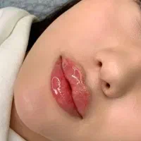 ژل/فیلر/بوتاکس/پی آرپی/بایو فیلر و چربی|خدمات آرایشگری و زیبایی|کرج, گوهردشت|دیوار