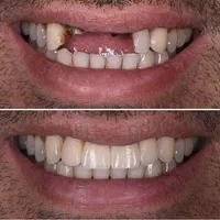 دندانپزشکی/ایمپلنت/لمینت/کامپوزیت زیبایی|خدمات آرایشگری و زیبایی|تهران, مهران (سیدخندان)|دیوار