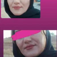 چاقی صورت و بدن تضمینی|خوردنی و آشامیدنی|طبس, |دیوار