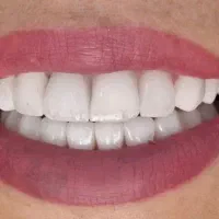 استخدام دستیار دندانپزشک