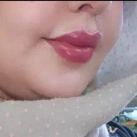 ژل بوتاکس مزو|خدمات آرایشگری و زیبایی|صدرا-فارس, فاز ۱|دیوار